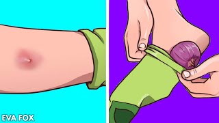 Boils can be painful and annoying but here's how to get rid of them the natural way