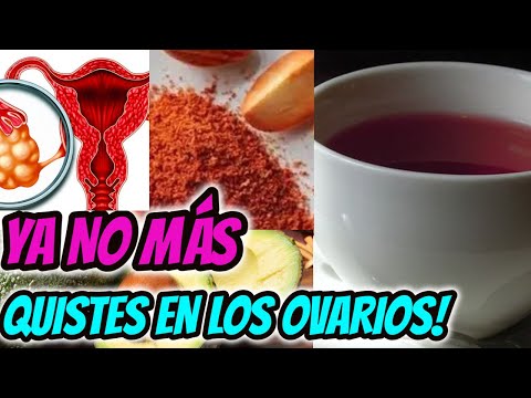 CÓMO ME CURE LOS OVARIOS POLIQUÍSTICOS /Una sola SEMILLA DE AGUACATE hará esto en tu cuerpo