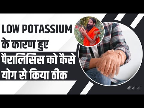 लो पोटैशियम (Low Potassium) के कारण हुए पैरालिसिस (Paralysis) को कैसे योग से किया ठीक | Swami Ramdev