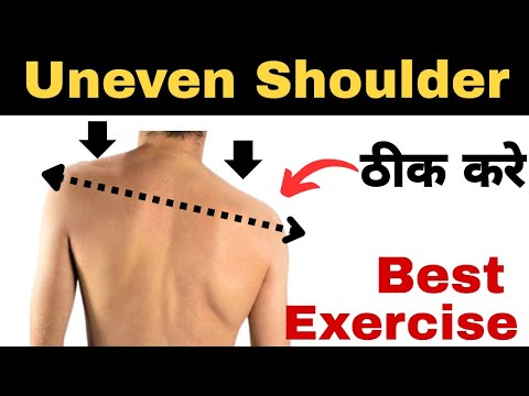 Uneven Shoulder correction Exercise in hindi.How to Correct Uneven Shoulder. #unevenshoulder #kandhe