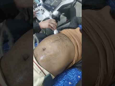 Sonography से शरीर के ऑर्गन को जानना बहुत जरूरी है @YogaRamesh