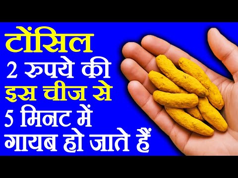 गले में दर्द और टॉन्सिल का इलाज - Gale Me Dard aur Tonsil Ka ilaj - How To Cure Tonsil & Sore Throat