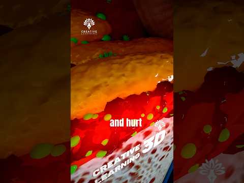 This Tiny Mistake Can Make You Go Deaf 😨 #earinfection  #short - Creativelearning3d