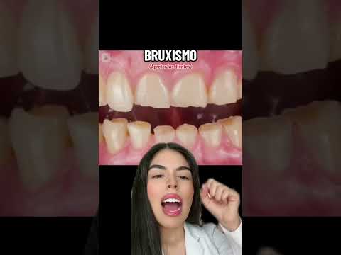 CONSECUENCIAS DE MALOS HÁBITOS PARA TUS DIENTES🥲🫠🦷 #shorts