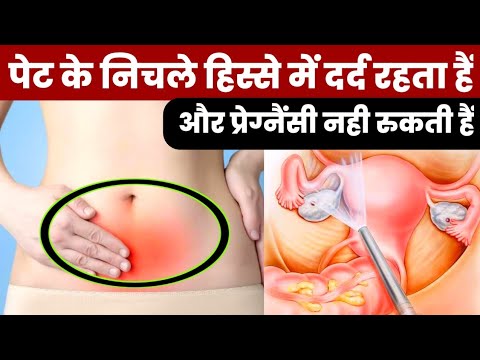 पेट के निचले हिस्से में दर्द रहता हैं और प्रेग्नैंसी नही रुकती है|trying to get pregnancy|pregnancy|