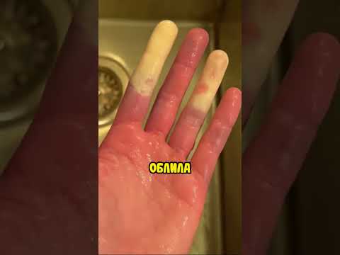 Схватила кубик льда 😳