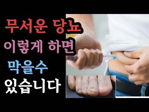 치명적 당뇨병, 이렇게하면 막을수 있습니다