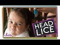 Understanding Head Lice