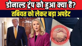 Donald Trump Health Update : ट्रंप की तबीयत पर आया अपडेट, डॉक्टरों ने दी जानकारी | America