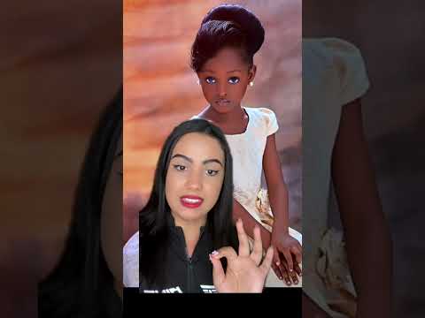 Crianças mais raras do mundo #criancas #kids #curiosidades