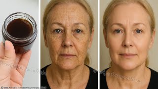 At 60 With No Wrinkles! ✨ Erase Pigmentation and Hyperpigmentation, 🌺 Glowing Skin Tone Naturally