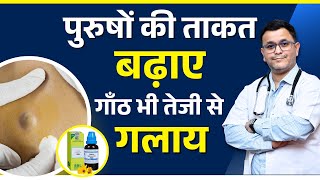 5 BEST uses of Conium Maculatum 30/ 200 Homeopathic Medicine
