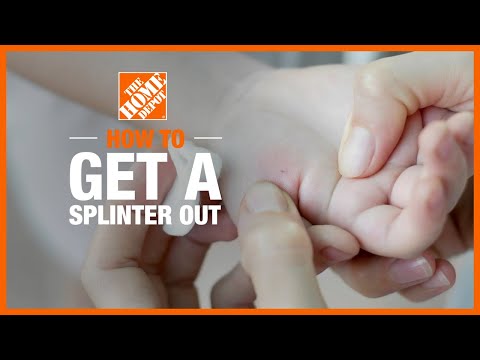 How to Get a Splinter Out