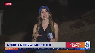 Child attacked by mountain lion in Malibu