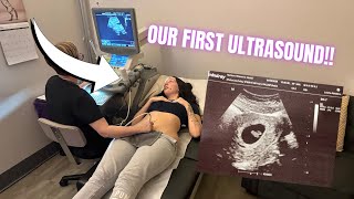 WE GET TO SEE OUR BABY FOR THE FIRST TIME!