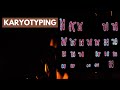Human Chromosomes and Karyotyping Concepts