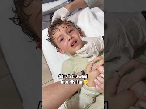 Crab Crawled Into This Boy’s Ear