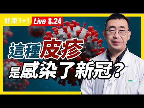 2021英國大型研究：約1/5新冠患者皮膚紅疹是唯一症狀！身體出現哪些皮膚問題，可能與新冠病毒有關？新冠紅疹和普通皮膚病紅疹要怎樣區分？這種情況及早就醫！（2021.8.24）| 健康1加1 · 直播