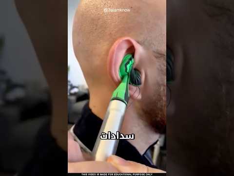 لماذا تعلق السدادات في أذنهم