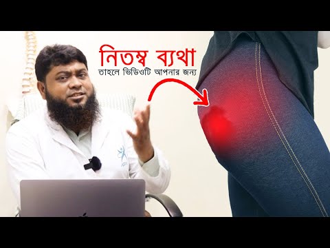 পাইরিফরমিস সিনড্রোমের কারণ, সমস্যা ও চিকিৎসা