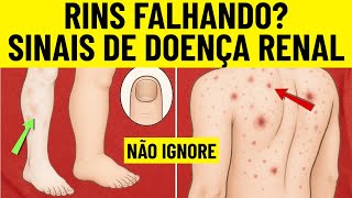 Sinais cutâneos de doença renal | Sintomas de insuficiência renal | DRC | Doença renal