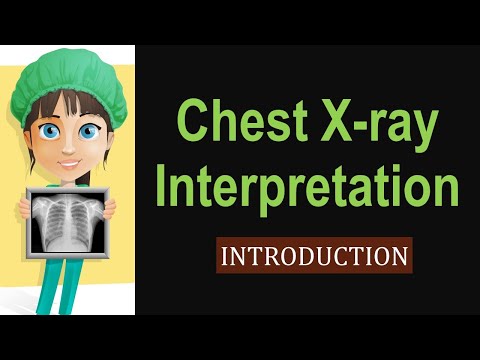 Cpt Code Chest Xray 2 View 2021 - 08/2021