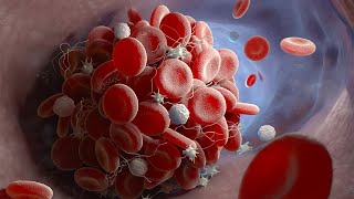 Thromboembolic Drugs Part 1: Principles of Platelet Activation