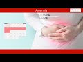 Understanding Anemia