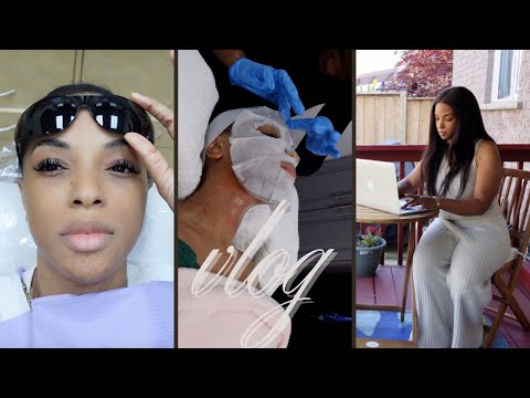Tooth extraction, Naomi's got a Job & New Hair Journey | ROCHELLE VLOGS