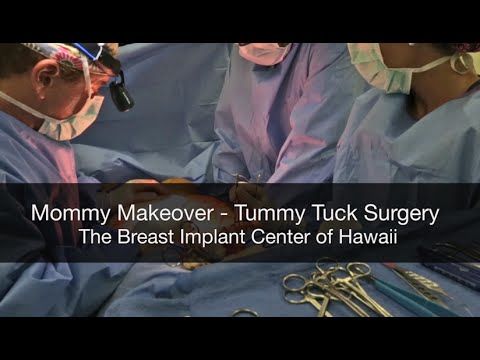 Tummy Tuck Surgery (Abdominoplasty) - Graphic - Mommy Makeover Hawaii