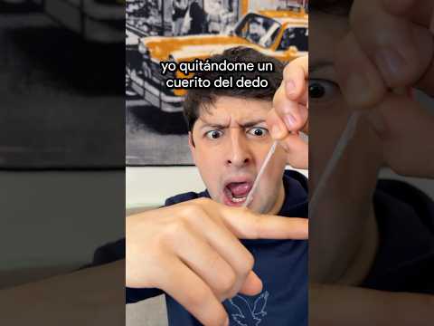 Cuando te quitas un cuerito del dedo 😩 #shorts