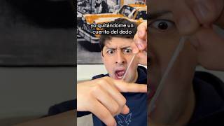 Cuando te quitas un cuerito del dedo 😩 #shorts