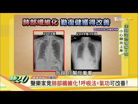 病毒攻肺導致纖維化！病患咳不停、動就喘！復健能改善？健康2.0