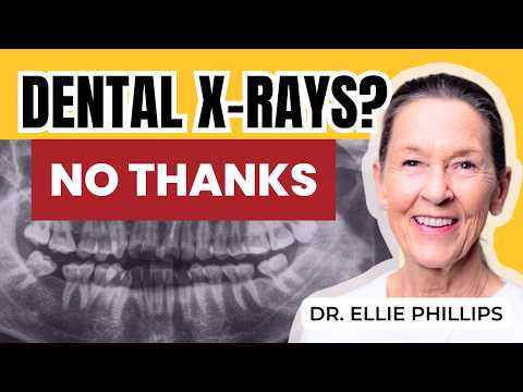 Do You Need Dental X-Rays?