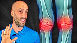 Dame 7 DÍAS para ELIMINAR tu DOLOR de RODILLA PARA SIEMPRE