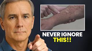 When Do You Actually Start Getting Cancer Screenings In Sjogren? A Doctor Explains