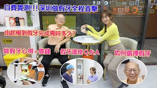 自費實測!!!深圳做假牙全程直擊,由起模到假牙完成需時多久?做假牙心得 +價錢,假牙護理 Q & A,如何選擇適合自己假牙