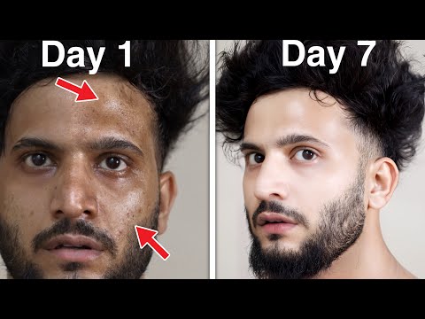 7 Skincare Hacks[10X Glow on Your Skin]|Tips For Naturally Glowing Skin & Home Remedy