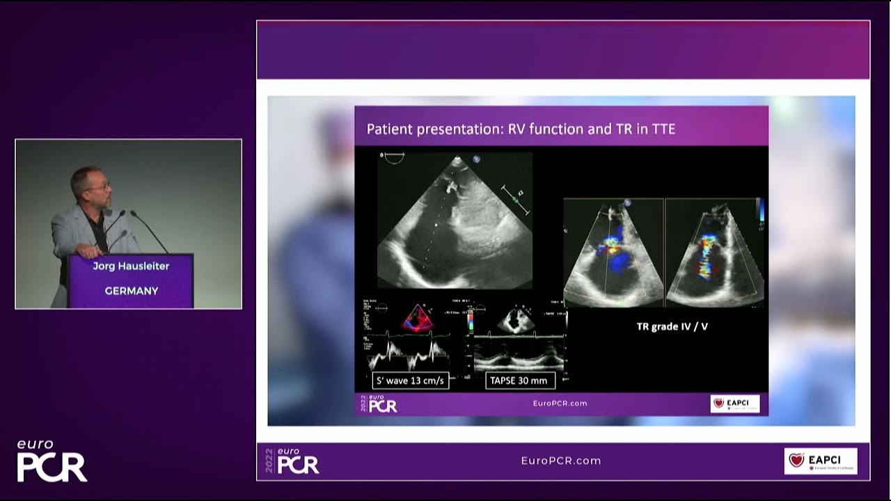 A patient-focused transcatheter