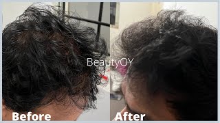 3 TIPS TO REGROW THICK HAIR, LONG HAIR, STRONG HAIR FASTER IN 6 MONTHS FOR MEN & WOMEN | BEAUTYOY