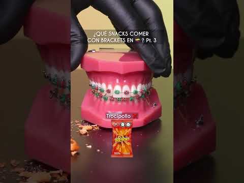 ¿Qué comer con brackets en ?? ? - Pt.3 Odontología Láser #Shorts