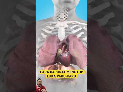 CARA DARURAT MENUTUP LUKA PARU-PARU