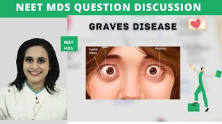 NEET MDS Endocrine Q&A: Graves' Disease Decoded!