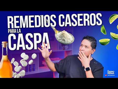 REMEDIOS CASEROS PARA CASPA || Consejos de un dermatólogo