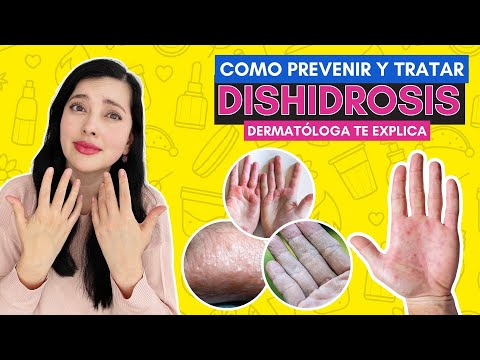 COMO Controlar la DISHIDROSIS 🤔✨👩🏻‍⚕️