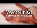 Thumb Anatomy and Function in Magic