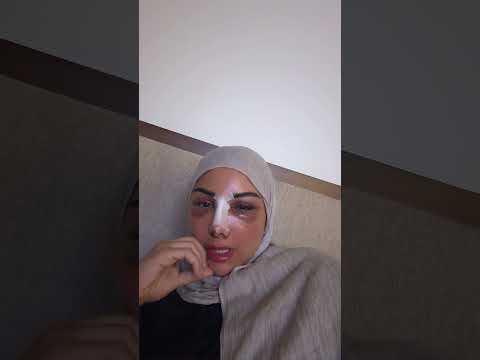 اناا حره