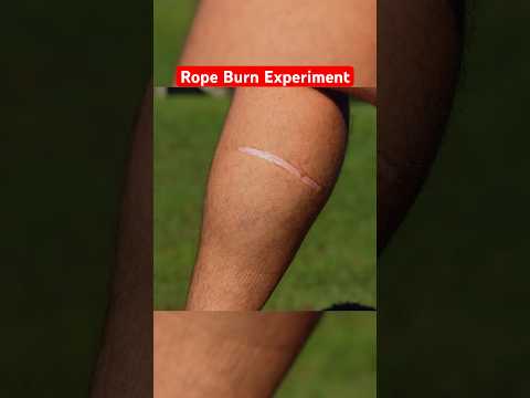 Insanely Painful ROPE BURN Experiment… #funny #science #comedy