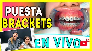 Así es COMO se 𝗣𝗢𝗡𝗘𝗡 los 𝐁𝐑𝐀𝐂𝐊𝐄𝐓𝐒 𝐌𝐄𝐓𝐀𝐋𝐈𝐂𝐎𝐒 - Instalación de Brackets Paso a Paso (Video en 🔴 𝑽𝑰𝑽𝑶)