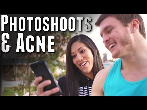 Photoshoot Vlog & Dropping Accutane!
